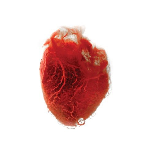 Akron/Family: Love Is Simple {Vinyl LP}